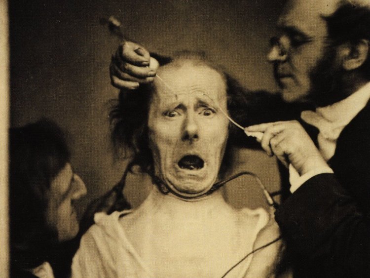 5. Французский невропатолог Гийом Дюшен в 1860-х проводил исследования выражений лица человека, воздействуя на своих пациентов электрическим током. Его медицинские эксперименты стали первыми в мире, запечатленными на камеру.