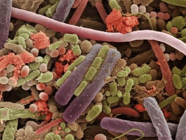 Бактерии на поверхности человеческого языка.