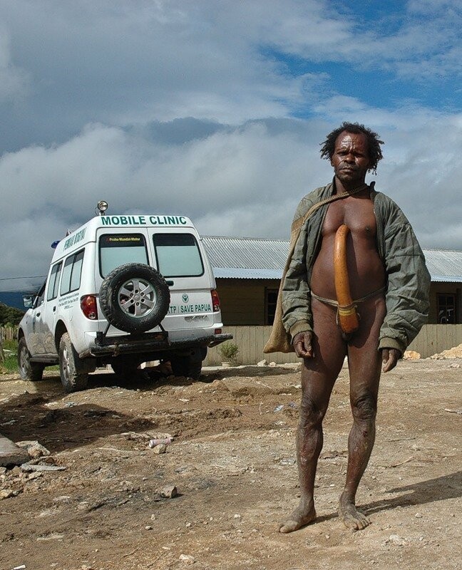 Сегодня подобное можно увидеть у мужчин некоторых районов острова Новая Гвинея, которые  прикрывают свой пенис специальным футляром под названием котека