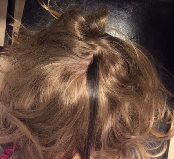 15. «У моего ребёнка есть прядь волос, которая гораздо темнее, чем остальные волосы»