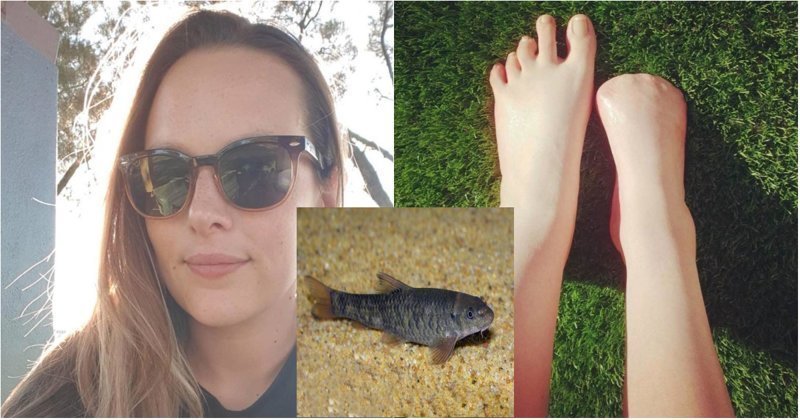 Спа из ада: девушка лишилась пальцев на ноге после пилинга рыбками в Таиланде