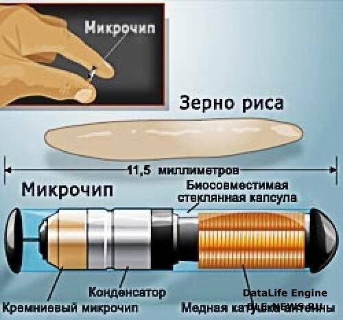 Чипы для людей — реальность 21 века