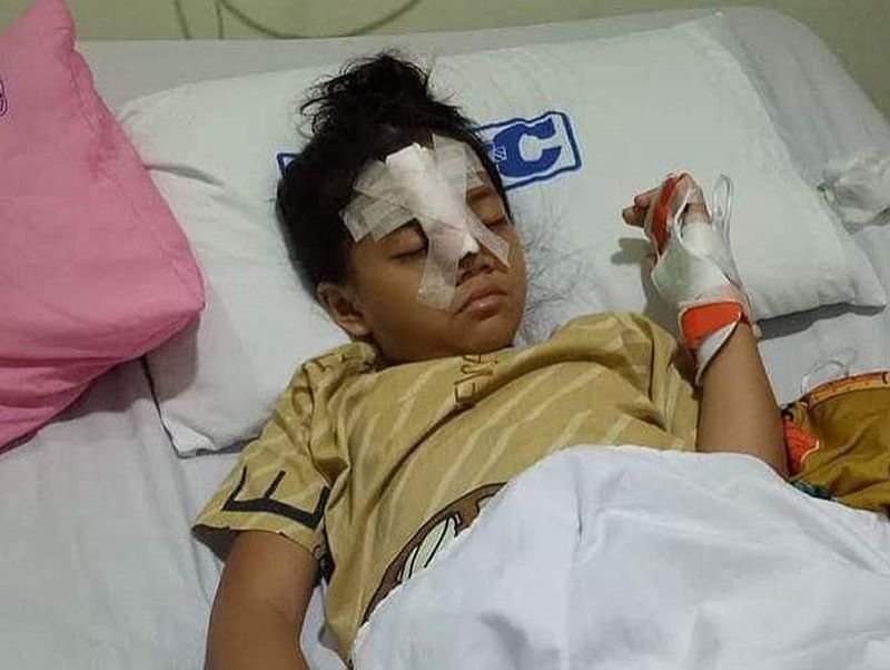 Храбрая девочка была госпитализирована в больницу со сломанным носом и многочисленными синяками.  Два дня спустя её отпустили домой