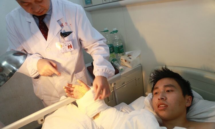 В Китае оторванную руку пациента спасли неожиданным способом