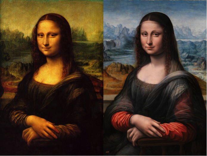 Чем болела Мона Лиза?