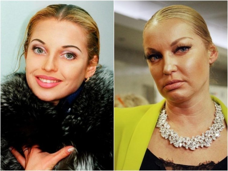 Анастасия Волочкова, 42 года