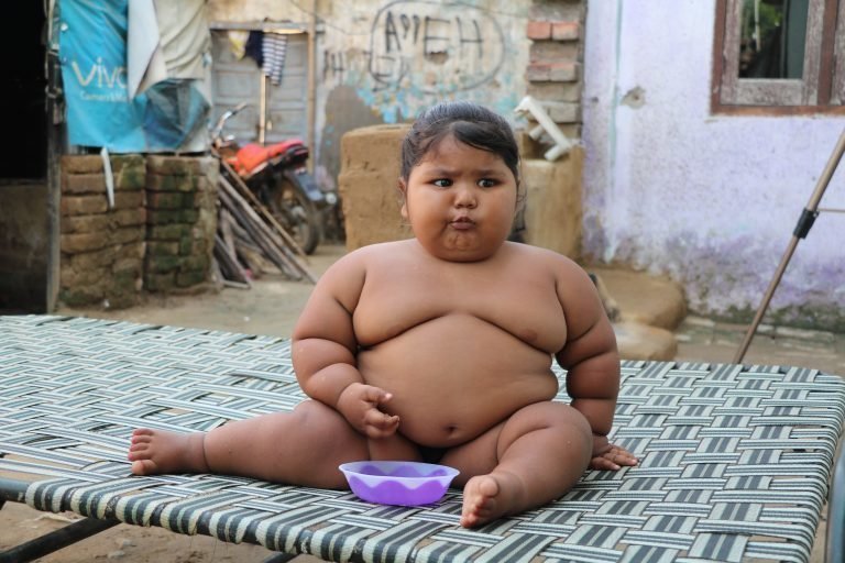 16-месячный ребенок весит 25 кг из-за редкого врожденного дефекта