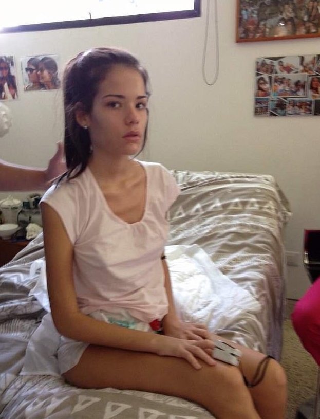 Молодую венесуэлку парализовало из-за контрацептивов