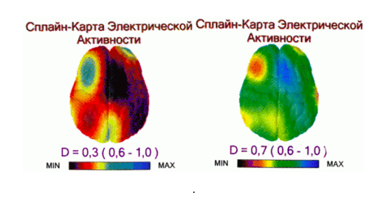 Открытие пограничной воды позволит замедлить процессы старения