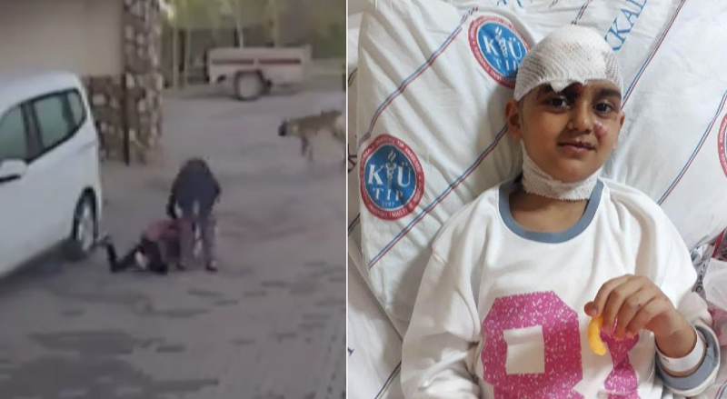 Отважная мать спасла ребенка, разжав челюсти питбулю: видео