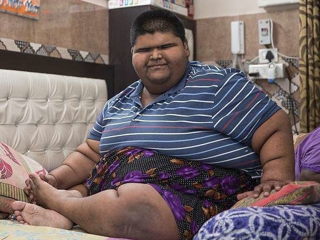 Мировые СМИ совсем недавно называли самым толстым ребенком на планете 14-летнего жителя Индии Михира Джаина