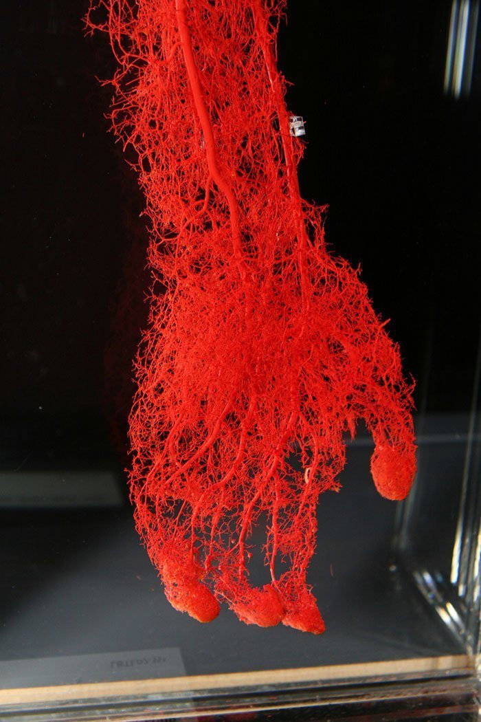 Кровеносные сосуды руки (её артериальная сеть).
