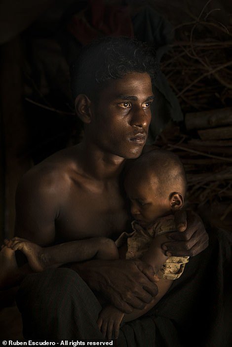 Отец успокаивает своего больного двухлетнего сына. Бангладеш. Лагерь беженцев из Мьянмы. Фотограф: Рубен Эскудеро, Мексика