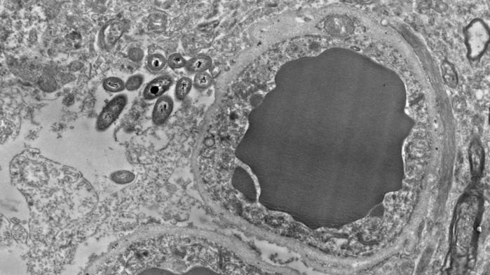 Ученым удалось сделать снимок с высоким разрешением, на котором видны бактерии на пробах мозговой ткани
