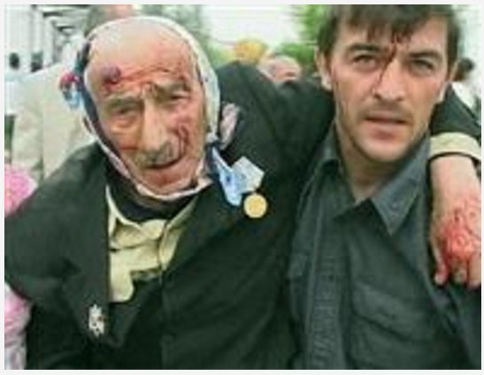 Пострадавшие мирные жители во время взрыва на стадионе «Динамо» в Грозном, где был взорван глава Чечни Ахмат Кадыров. Чечня, 9 мая 2004 года