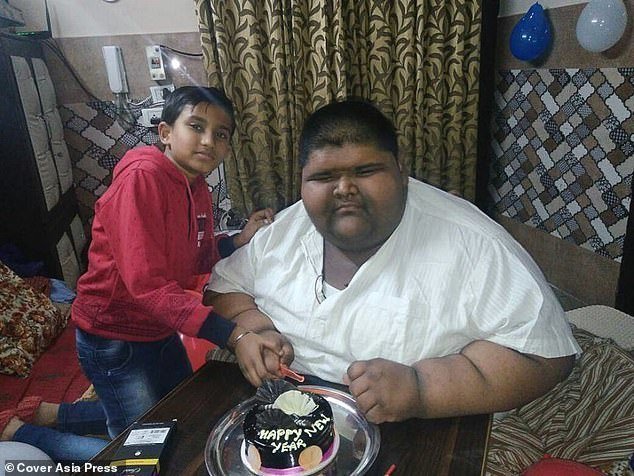 Самый толстый мальчик в мире уменьшил себе желудок и похудел на 100 кг