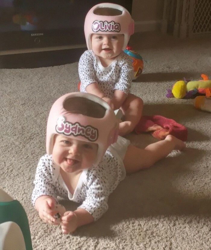 24. "Наши близнецы уже вторую неделю носят свои шлемы"