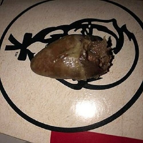 В блюде из KFC клиентка нашла чьи-то мозги