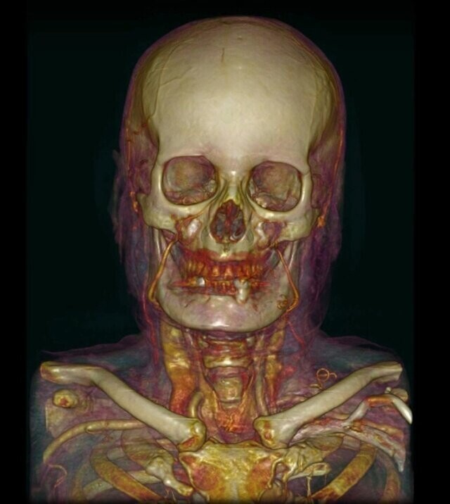 Необычный взгляд на человеческое тело при помощи медицинских приборов
