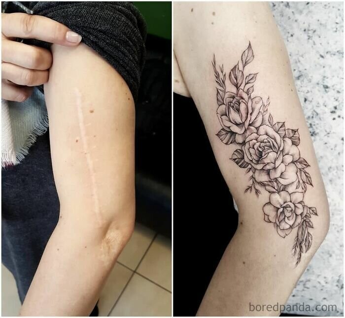 Крутые примеры татуировок для сокрытия шрамов вашей бурной молодости