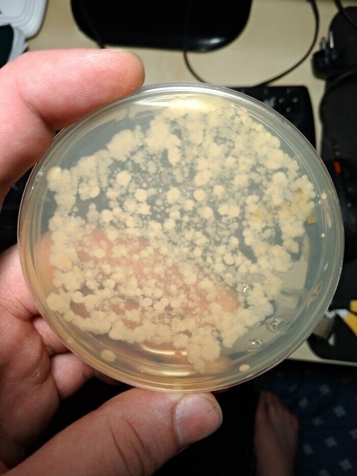 Биолог показал, сколько бактерий таит в себе кухонная губка. Он рекомендует прогревать ее 30 секунд перед мытьем посуды, чтобы уничтожить паразитов