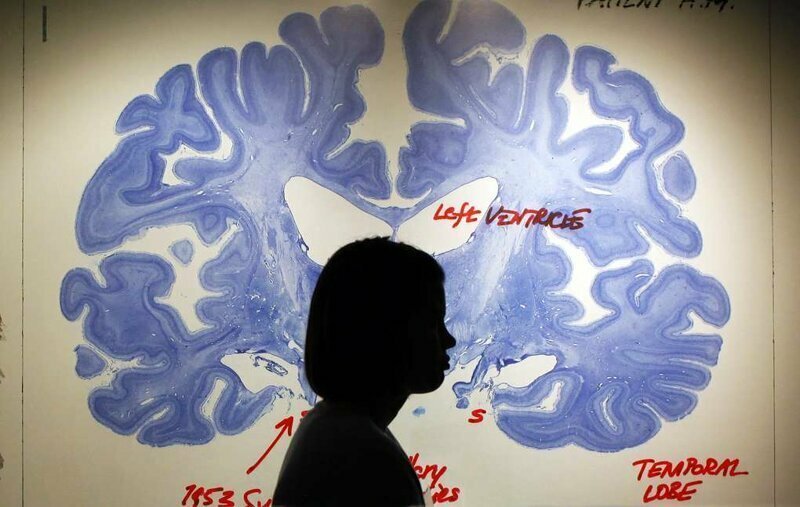 Ученые считают, что мозг женщин стареет почти на четыре года медленнее, чем у мужчин