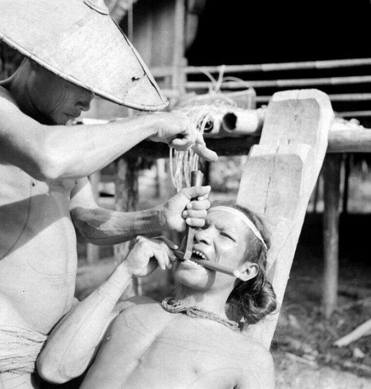 Заточка зубов у индонезийских племен, 1938 год.