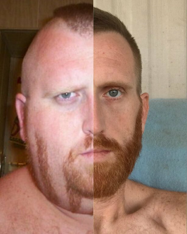 15. «Моё лицо до и после того, как я похудел»