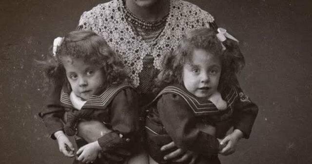 Дейзи и Виолетта Хилтон родились 5 февраля 1908 года в Англии