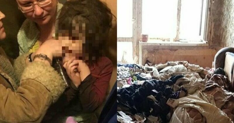 В Москве нашли и спасли пятилетнюю девочку с вросшей под кожу резинкой для волос