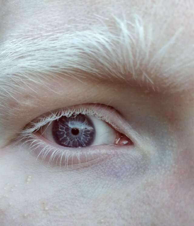 «У меня фиолетовые глаза»