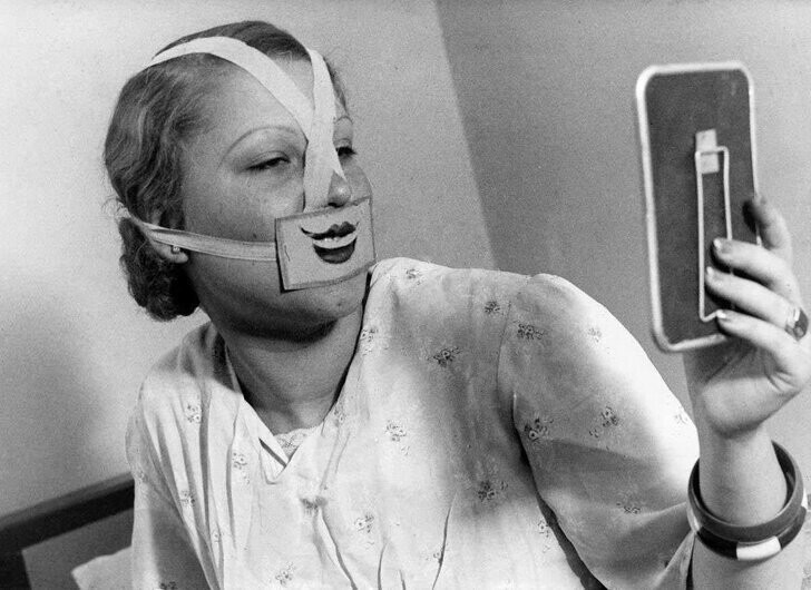 Женщина использует специальную повязку для борьбы с депрессией, Будапешт, 1937 год 