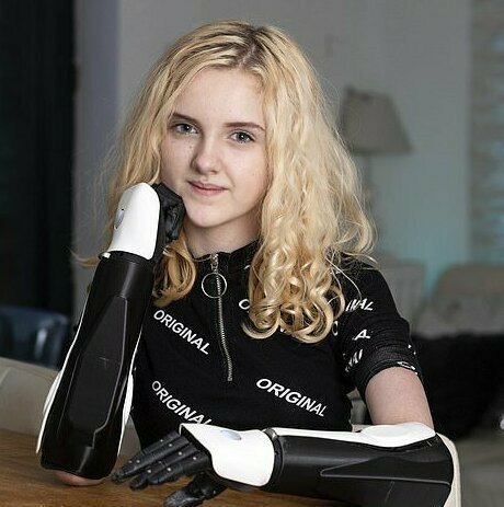 Джеймс Кэмерон подарил школьнице бионические протезы