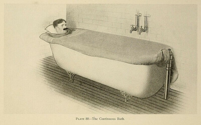 Душ, пар и клизма от паранойи и алкоголизма: иллюстрации из «Практической гидротерапии» 1909 года