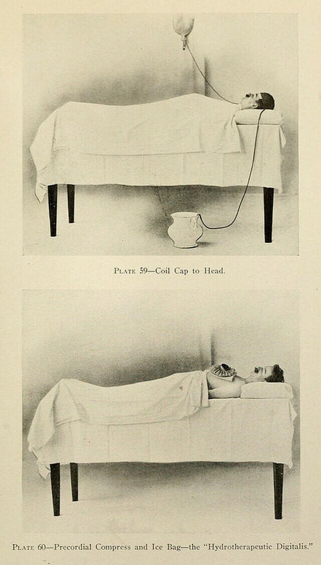 Душ, пар и клизма от паранойи и алкоголизма: иллюстрации из «Практической гидротерапии» 1909 года