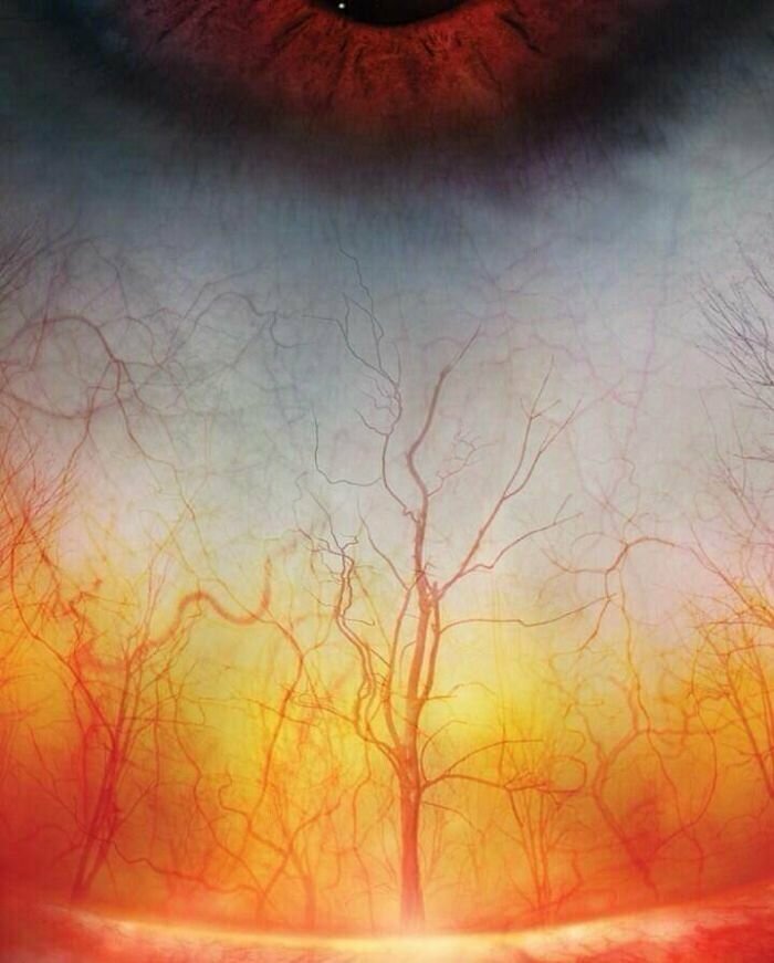 13. Кровеносные сосуды в глазу человека похожи на красивый лес
