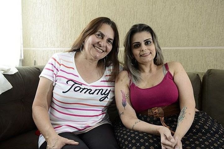 Из-за редкой болезни на ногах бразильской девушки выросли огромные опухоли