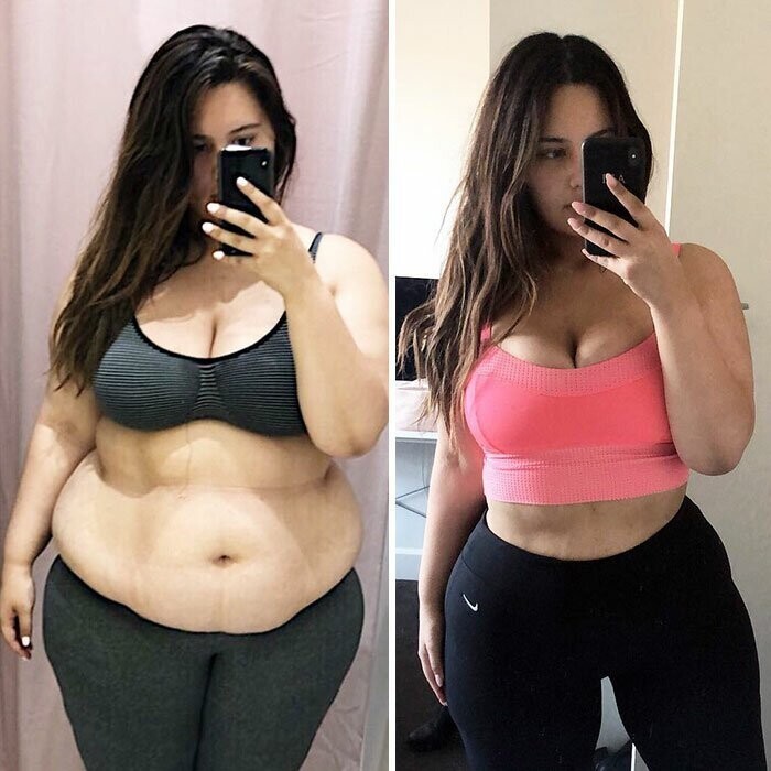 Похудевшая на 65 кг девушка показала откровенные фотографии "до и после"