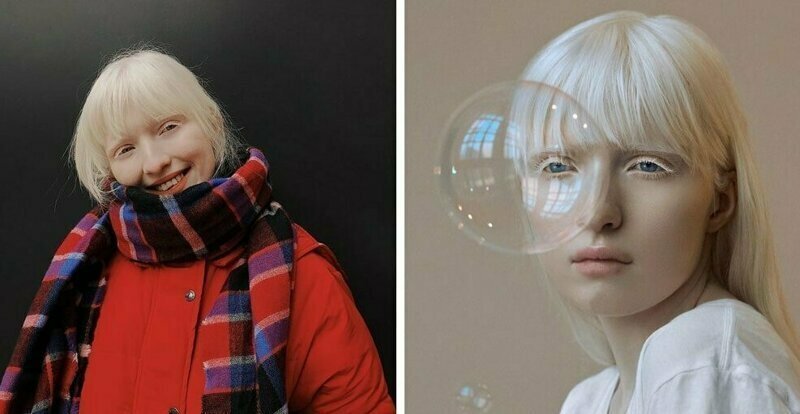 Настя Жидкова: модель-альбинос с нестандартной внешностью