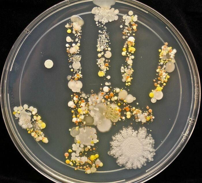 Бактерии, оставшиеся на  ладони 8-летнего мальчика, который играл во дворе и после этого не помыл руки