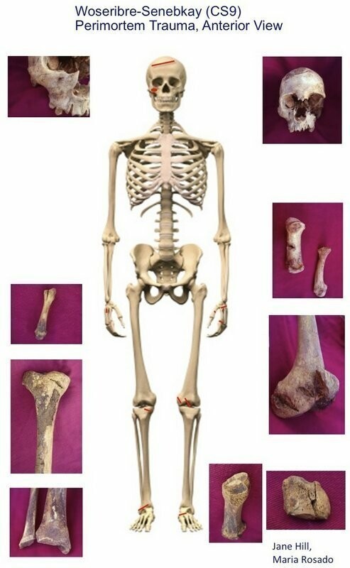 Скелет Сенебкея спереди, красным отмечены следы ударов, по бокам кости со следами ран.