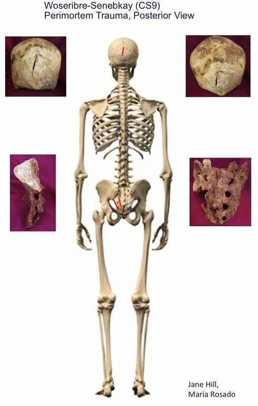 Скелет Сенебкея сзади, красным отмечены следы ударов, по бокам кости со следами ран.