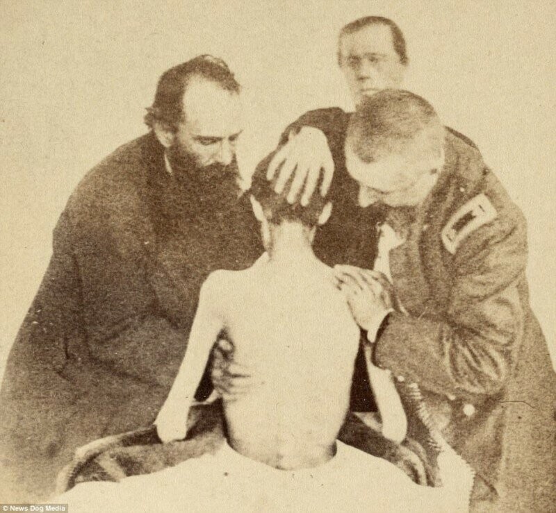 Неопознанный изможденный солдат получает помощь в больнице в мае 1865 года.