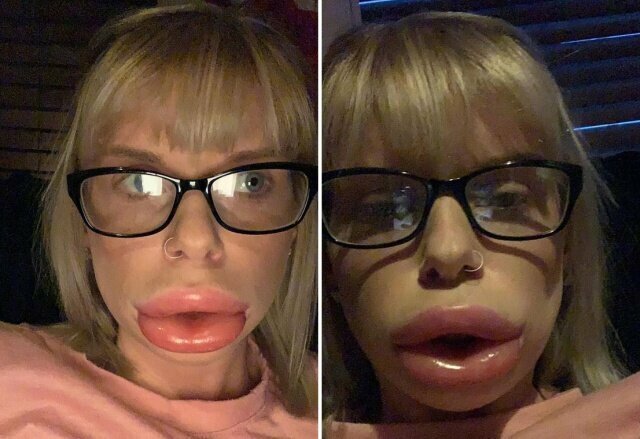 "Горшочек, не вари!": девушка показала эффект помады "для увеличения губ"