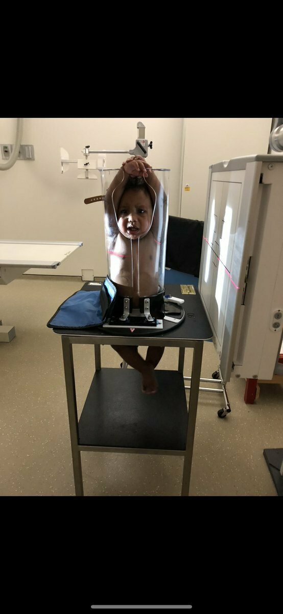 Рентген для младенца: смешно или страшно?