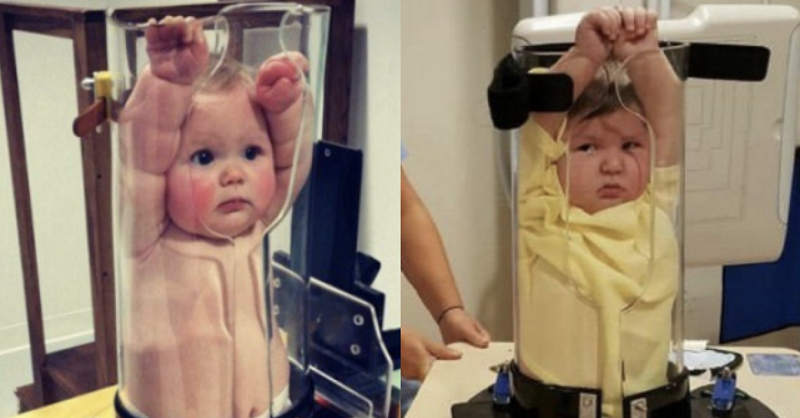 Рентген для младенца: смешно или страшно?