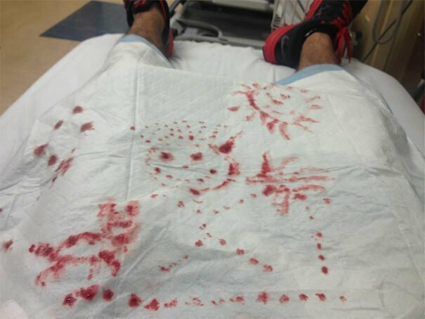 "Мой бойфренд сломал палец. Вот так он развлекался, лежа в приемном отделении в ожидании врачей"