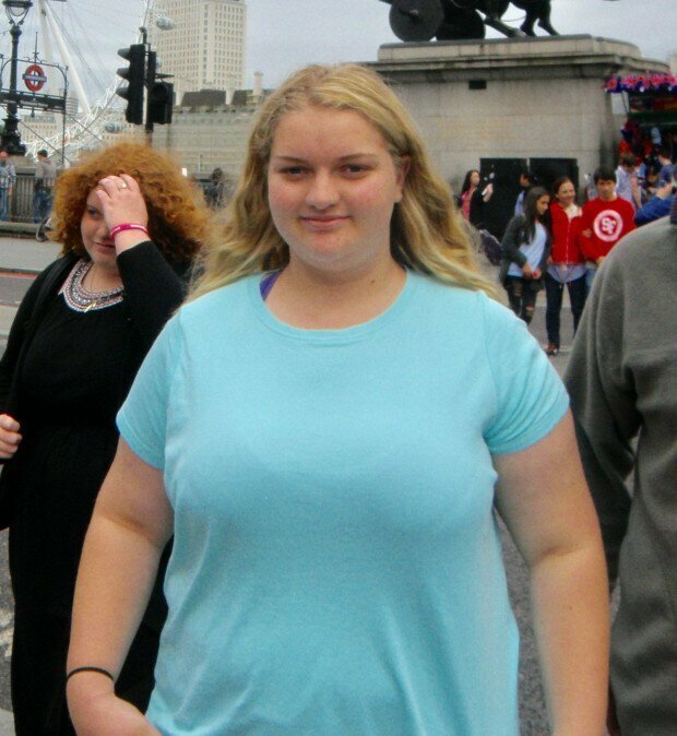 Девушка сбросила 63 кило, отказавшись от сахара