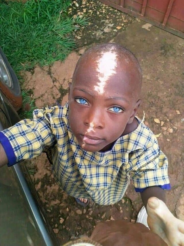5. Африканский мальчик-альбинос, напоминающий героя из мультфильма "Аватар". Удивительные люди живут на планете