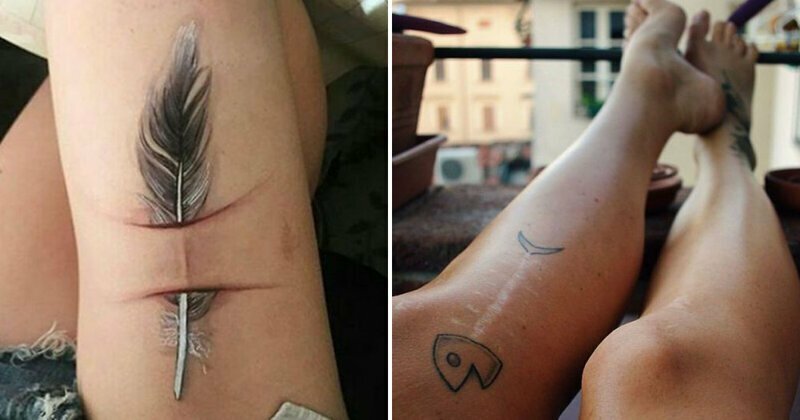 15 человек, которые блестяще превратили шрамы в татуировки